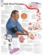 Image result for High Blood Pressure Arteries