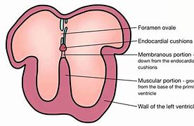 Image result for Interatrial Septum Formation