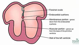 Image result for Interventricular Septum