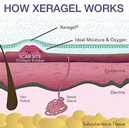 Image result for Xeragel Gel