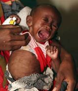 Image result for Starving Babies in Africa