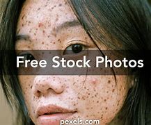 Image result for Pimple Face Wallpaper