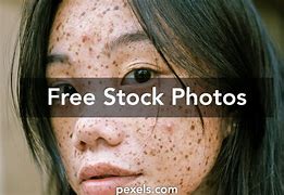 Image result for Pimple Face HD Images