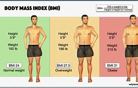 Image result for BMI Adipositas