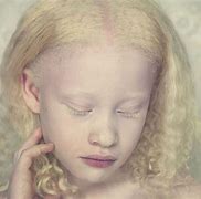 Image result for Albino Child in Pagent