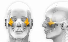 Image result for Zygomatic Tape