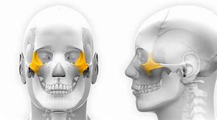 Image result for Zygomatic Smile