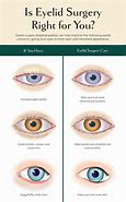 Image result for Hooded Eyes Drawing