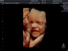 Image result for Mother 4D Baby Scan