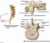 Image result for L5 Lumbar Vertebrae