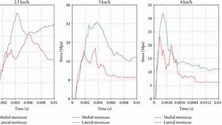 Image result for Meniscus Stress