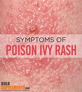 Image result for Poison Ivy Rash African American