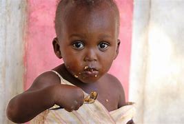 Image result for Starving Ethiopian Child