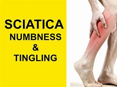 Image result for Sciatica Symptoms in Both Legs