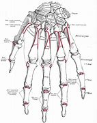 Image result for Capitate Bone Pain