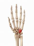 Image result for hamate bone x-ray