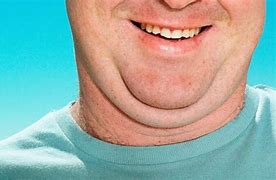 Image result for Double Chin Face