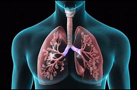 Image result for COPD Pinterest