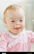 Image result for Down Syndrome Baby Pictures