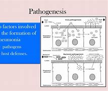 Image result for Pathogens Causing Pneumonia