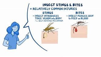 Image result for Bites and Stings Nursing PPT