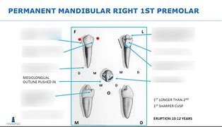 Image result for Mandibular 1st Premolar