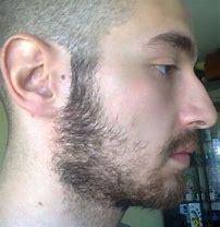 Image result for Weak Cheek Beard