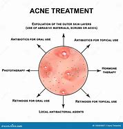 Image result for Treating Papules