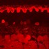 Image result for Ganglion Cells of the Retina