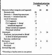 Image result for Vertebral Dissection On Angiogram