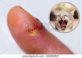 Image result for Cat Bite On Finger