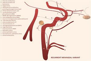 Image result for Recurrent Meningeal Nerve