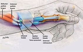 Image result for Extensor Pollicis Brevis Muscle Movements