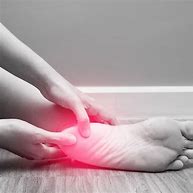 Image result for Plantar Fasciitis Orthotics