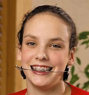 Image result for Orthodontic Headgear