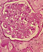 Image result for Periodic acid-Schiff Stain