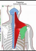 Image result for Inferior Trapezius