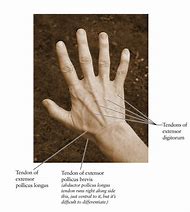 Image result for Dorsal Aspect Hand