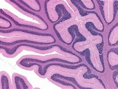 Image result for Brain Tissue Histology