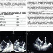 Image result for Cardiac CT Left Atrial Appendage Thrombus