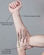 Image result for Flexors of the Forearm