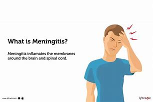 Image result for Meningitis Signs