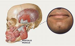 Image result for What Is Cleft Chin