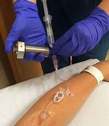 Image result for Pet Scan Injection