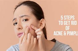 Image result for How to Get Rid Acne Bumps