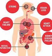 Image result for High Blood Pressure Risk Chart