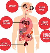 Image result for High Blood Pressure and Heart Disease