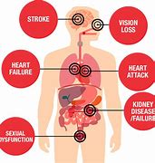 Image result for Google High Blood Pressure Image