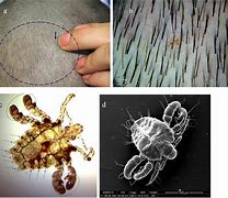 Image result for Human Parasites