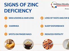 Image result for Zinc Kid Face